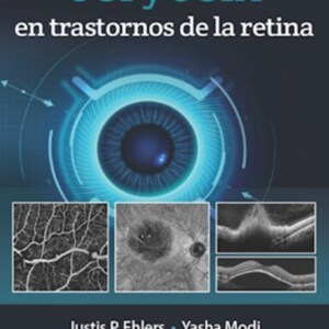 OCT y OCTA en trastornos de la retina.jpg