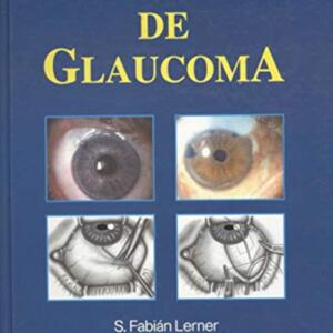 cirugia del glaucoma lerner.jpg