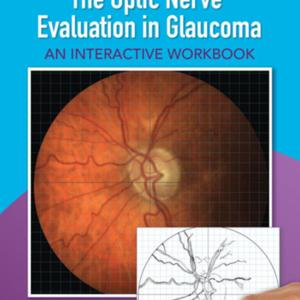The optic nerve evaluation.jpg The optic nerve evaluation.jpg