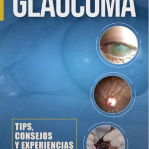 Glaucoma tips consejos.jpg