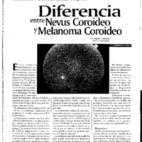 mo-14-2-p18-9 nevus vs melanoma coroideo - Materin.pdf