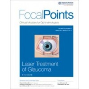 Focal Points laser treatment glaucoma.jpg