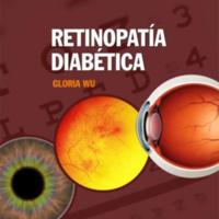 retinopatia diabetica.jpg