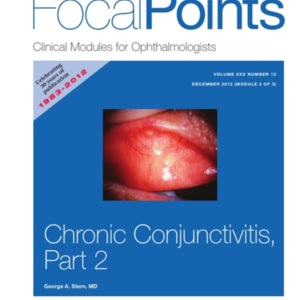 focal point conjuntivitis cronica 2.jpg