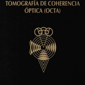 Angiografia por tomografia OCT-A.jpg Angiografia por tomografia OCT-A.jpg