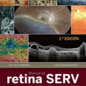 Manual de retina SERV.jpg Manual de retina SERV.jpg