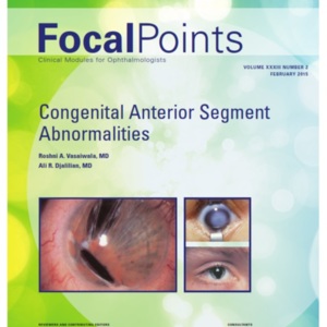 Focal Point 33-2 congenital anterior seg.jpg
