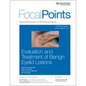 Focal Points evaluation benign eyelid.jpg