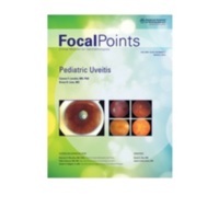 Pediatric uveitis.jpg Pediatric uveitis.jpg