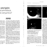 mo-24-3-p28-34 pterigion amniotica o injerto de conjuntiva.pdf