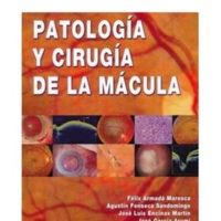 Patologia y cirugia de la macula.jpg