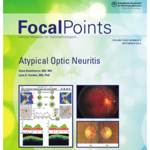 Focal Point 32-9 at optic neuritis.jpg Focal Point 32-9 at optic neuritis.jpg