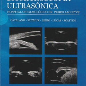 Atlas de biomicroscopia ultrasonica.png Atlas de biomicroscopia ultrasonica.png