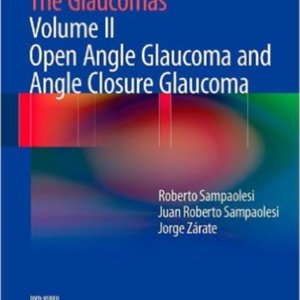 The glaucomas sampaolesi.jpg