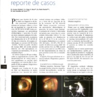 mo-24-3-p38-39 panuveitis.pdf