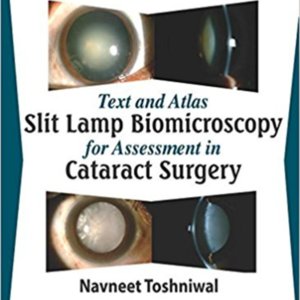 Text and atlas Slit lamp biomicroscopy cataract surgery.jpg Text and atlas Slit lamp biomicroscopy cataract surgery.jpg