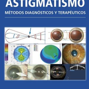 Astigmatismo metodos diagnosticos.jpg Astigmatismo metodos diagnosticos.jpg