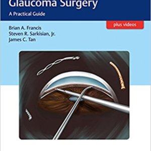 Minimally invasive glaucoma surgery.jpg