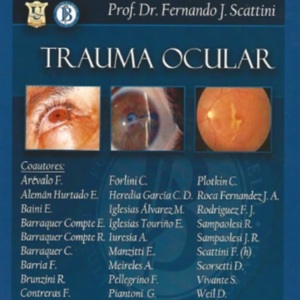 Trauma ocular.jpg