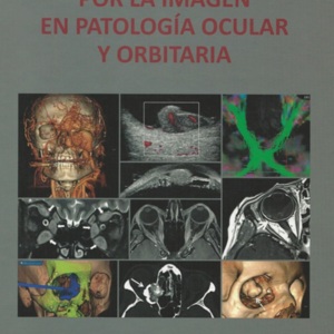 Diagnostico por la imagen en patologia ocular y orbitaria.jpg