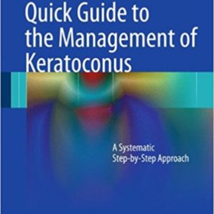 Quick guide to the management of keratoconus.jpg