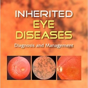 Inherited eye diseases.jpg