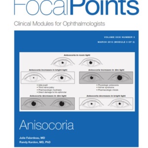 focal point anisocoria.jpg