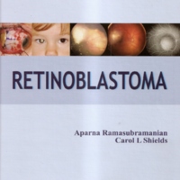 retinoblastoma.jpg