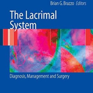 The lacrimal system.jpg