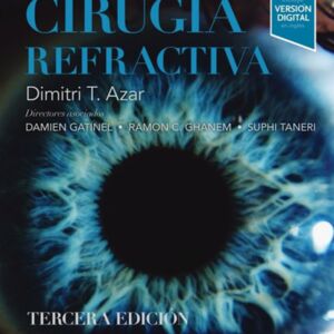 cirugia refractiva azar.jpg