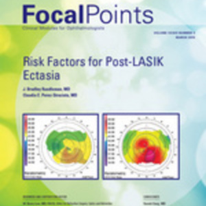 risk factors post lasik ectasia.jpg risk factors post lasik ectasia.jpg