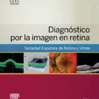 Diagnostico por la imagen en retina.jpg