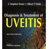 Diagnosis and treatment of uveitis.jpg