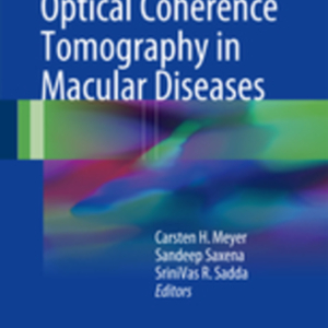 Spectral domain optical coherence tomography in macular.jpg