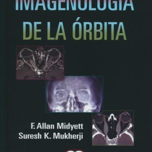 Imagenologia de la orbita.jpg