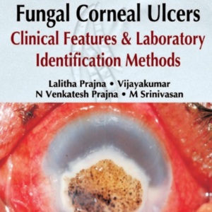 Aravinds atlas of fungal corneal ulcers.jpg