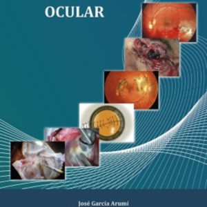 Traumatologia ocular.jpg