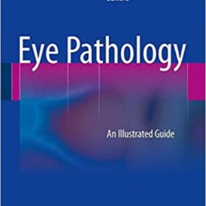 Eye pathology.jpg