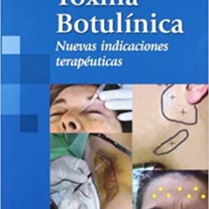 Toxina botulinica.jpg