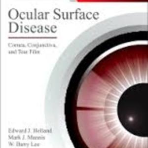 Ocular surface disease.jpg