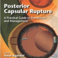 Posterior capsular rupture.jpg