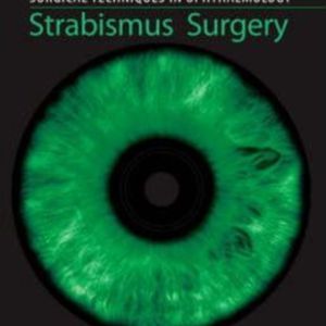 Strabismus surgery.jpg