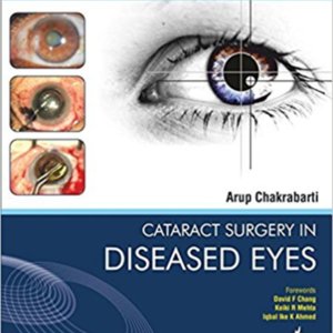 Cataract surgery in diseased eyes.jpg Cataract surgery in diseased eyes.jpg