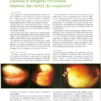 mo-20-1-p14-18-linfoma de conjuntiva.pdf