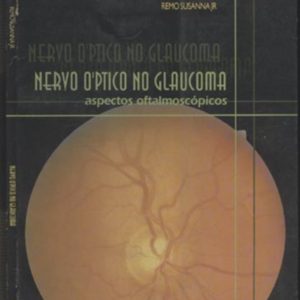 Nervo optico no glaucoma.jpg