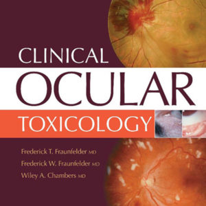 Clinical ocular toxicology.jpg