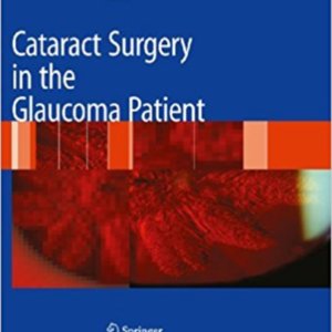 Cataract surgery in the glaucoma.jpg
