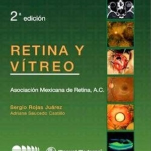 retina y vitreo rojas.jpg