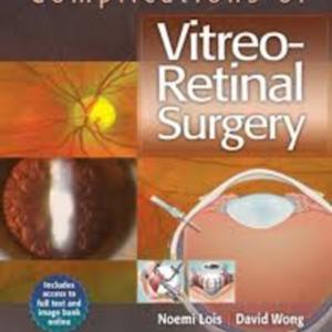 Complications of vitreo-retinal surgery.jpg