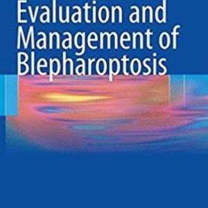 Evaluation and management blepharoptosis.jpg